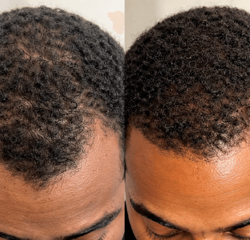 Before and after treatment results